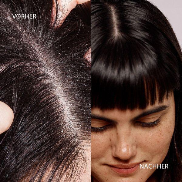 bodyguardapotheke DUCRAY KELUAL DS Anti-Schuppen-Shampoo Kauf eins, bekomm eins gratis
