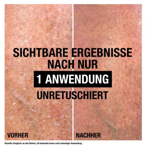 bodyguardapotheke NEUTROGENA Intense Repair CICA Bodybalsam Speichern exportieren