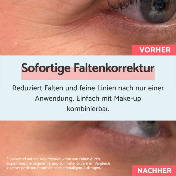 bodyguardapotheke Remescar Anti-Falten-Creme mit Soforteffekt 8ml Zeitlich begrenztes Angebot