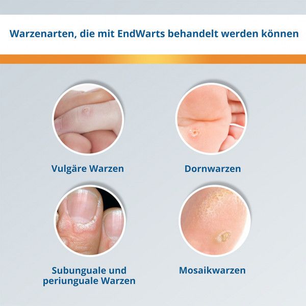 bodyguardapotheke ENDWARTS Classic Lösung Zeitbegrenzte Promotion