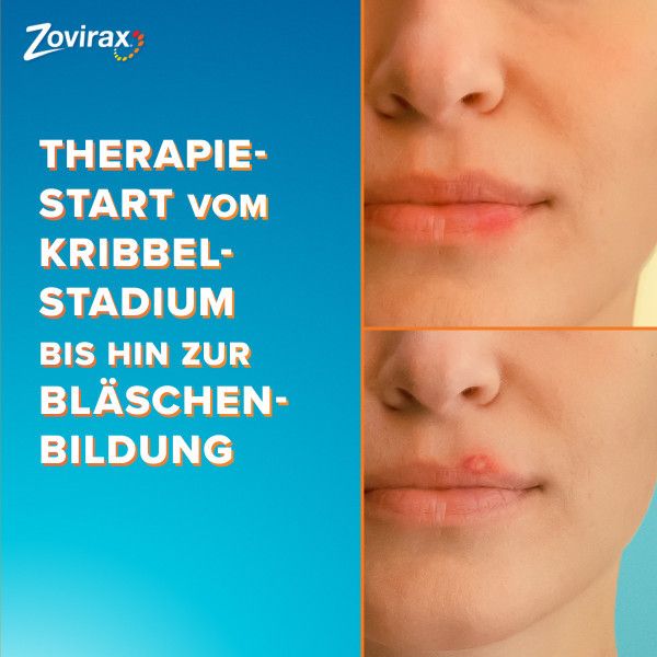 bodyguardapotheke ZOVIRAX Lippenherpes Creme Black Friday Preise