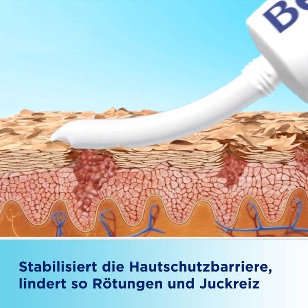 bodyguardapotheke BEPANTHEN Sensiderm Creme zur Linderung bei geröteten juckenden Hautstellen durch Stabilisierung der Hautbarriere 50% Rabatt für begrenzte Zeit