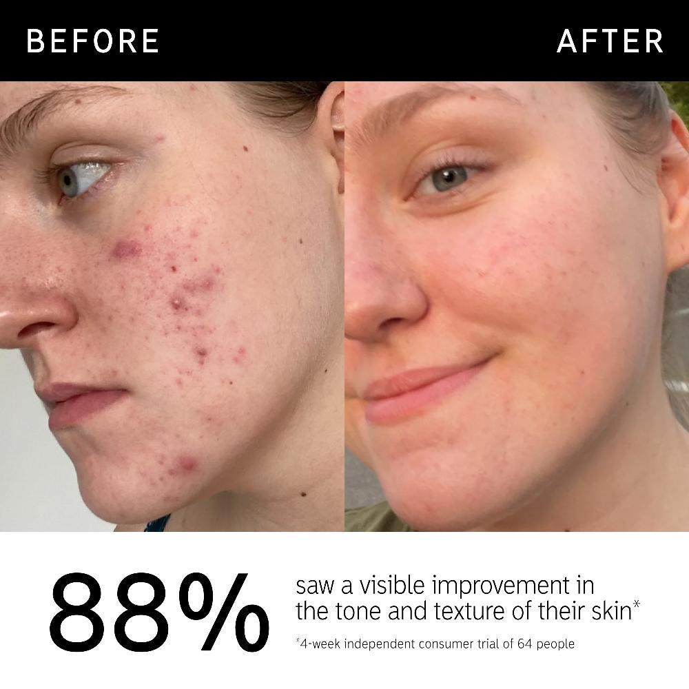 lookfantastic The INKEY List 15% Vitamin C und EGF Serum 30 ml Schlussverkauf