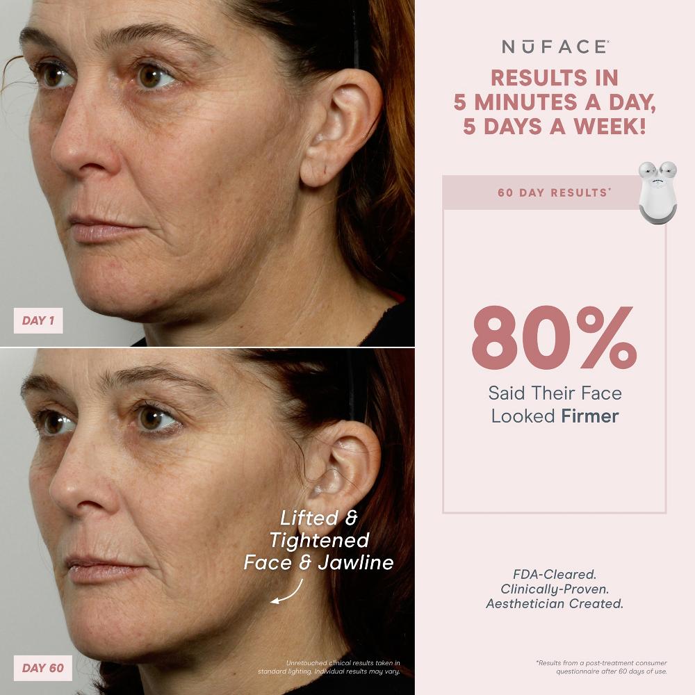 lookfantastic NuFACE® Mini Starterkit 50% Rabatt mit kostenlosem Versand
