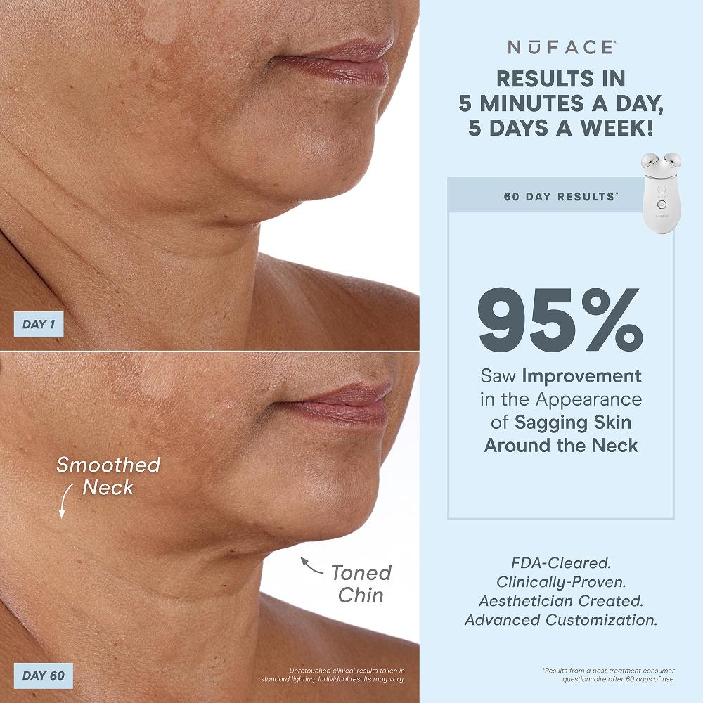 lookfantastic NuFACE Trinity+ and Effective Lip and Eye Attachment Set Vatertagsangebot