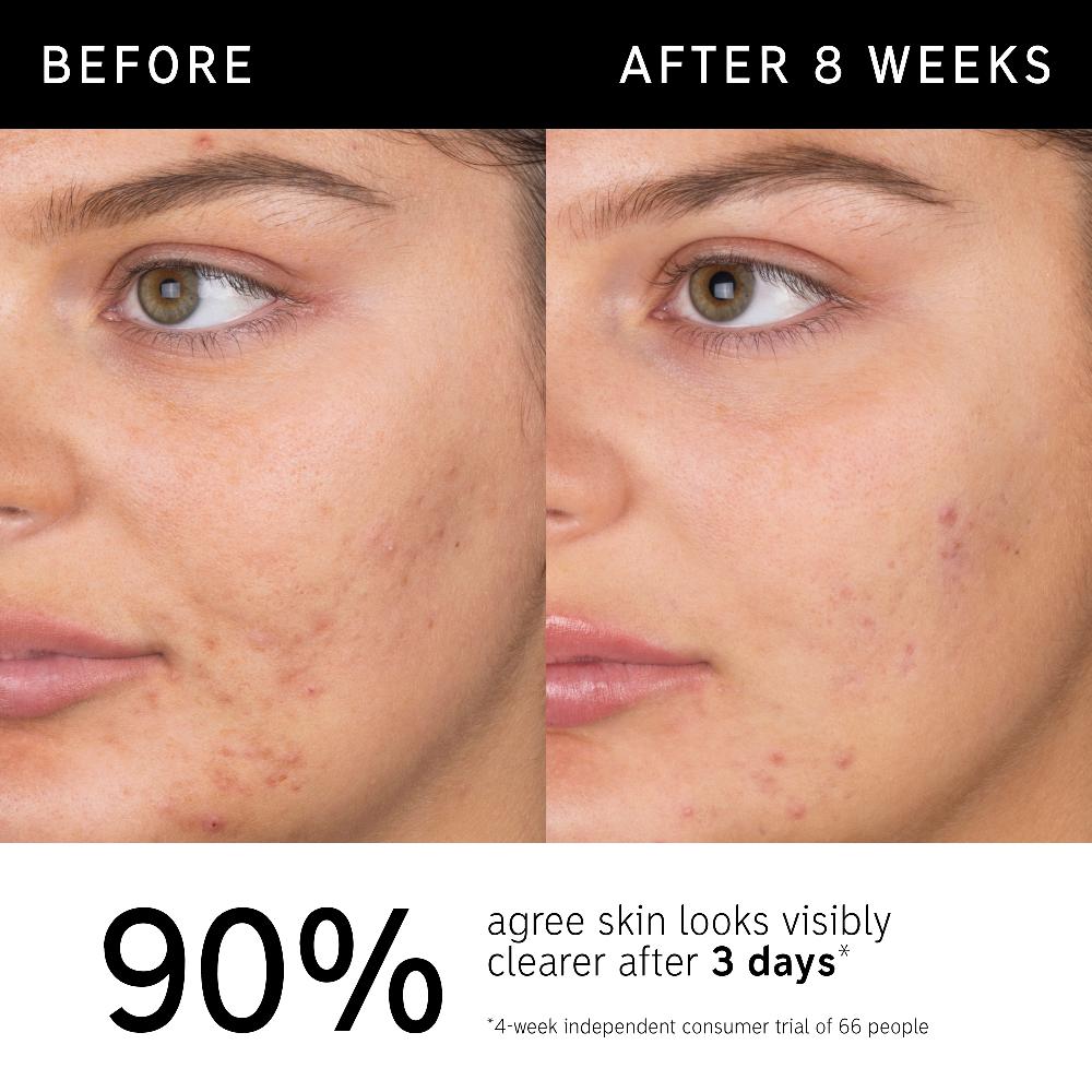 lookfantastic The INKEY List Salizylsäure-Gesichtsreinigung 150 ml JETZT KAUFEN