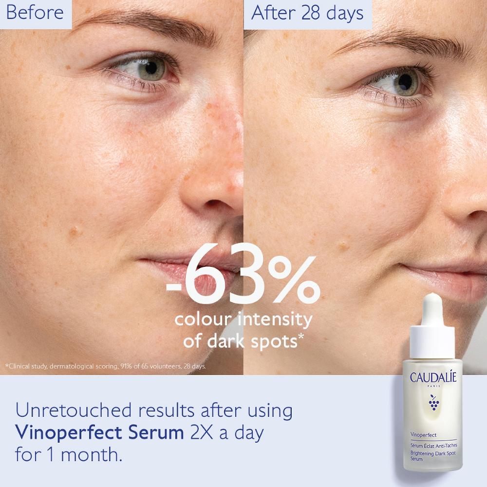 lookfantastic Caudalie Vinoperfect Aufhellendes Serum Gegen Dunkle Flecken 30 ml Nur für heute