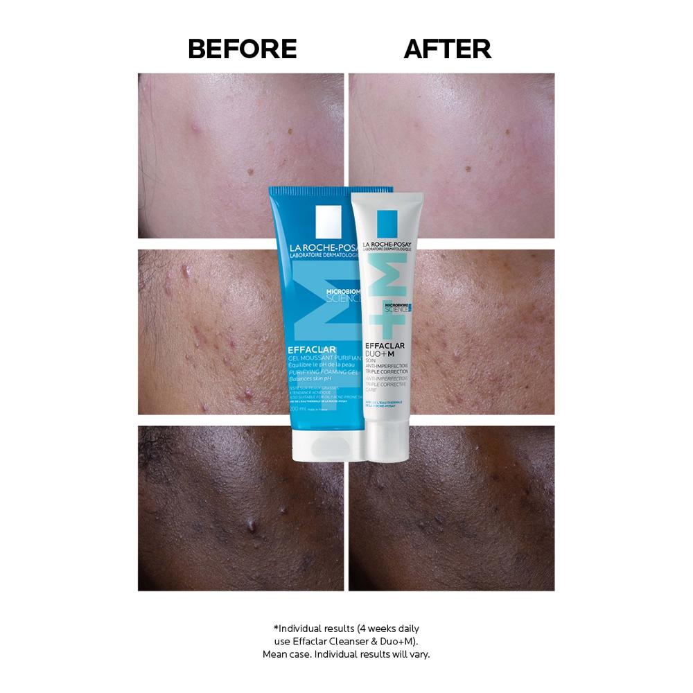 lookfantastic La Roche-Posay Effaclar Duo+M Unreinheitenkorrigierende Gel-Feuchtigkeitspflege für Fettige zu Unreinheiten Neigende Haut 40 ml Tiefpreis