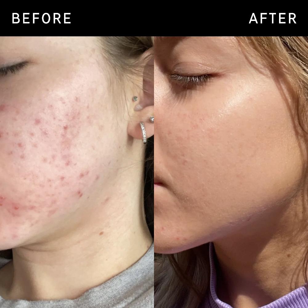 lookfantastic The INKEY List Niacinamid-Serum 30 ml Flash Sale