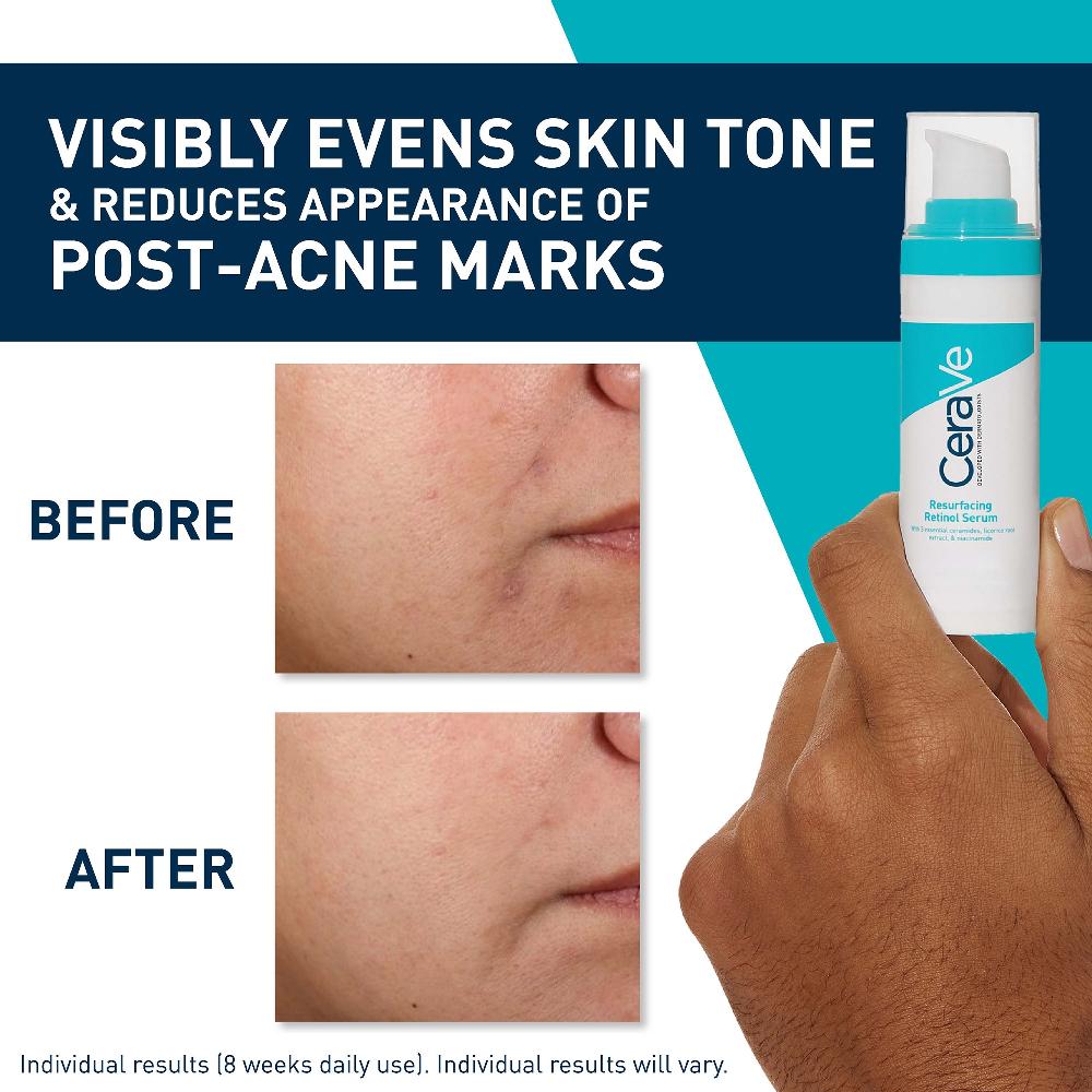 lookfantastic CeraVe Resurfacing Retinol Serum with Ceramides and Niacinamide for Blemish-Prone Skin 30ml Kostenloser Versand