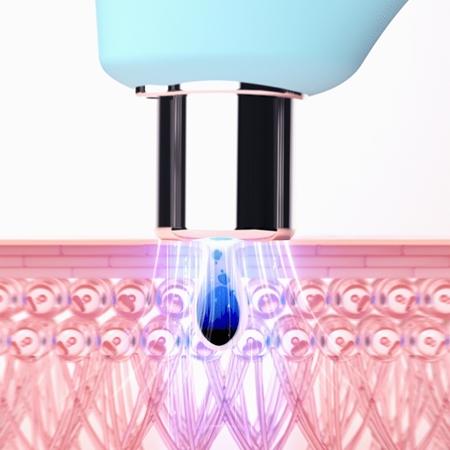 FOREO FOREO KIWI™ Vakuum-Mitesserentferner mit blauem LED-Licht Bis zu 65% Rabatt