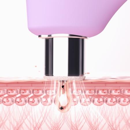 FOREO FOREO KIWI™ Derma Ausrüstung für Diamant-Mikrodermabrasion und Porenreinigung Lagerräumung